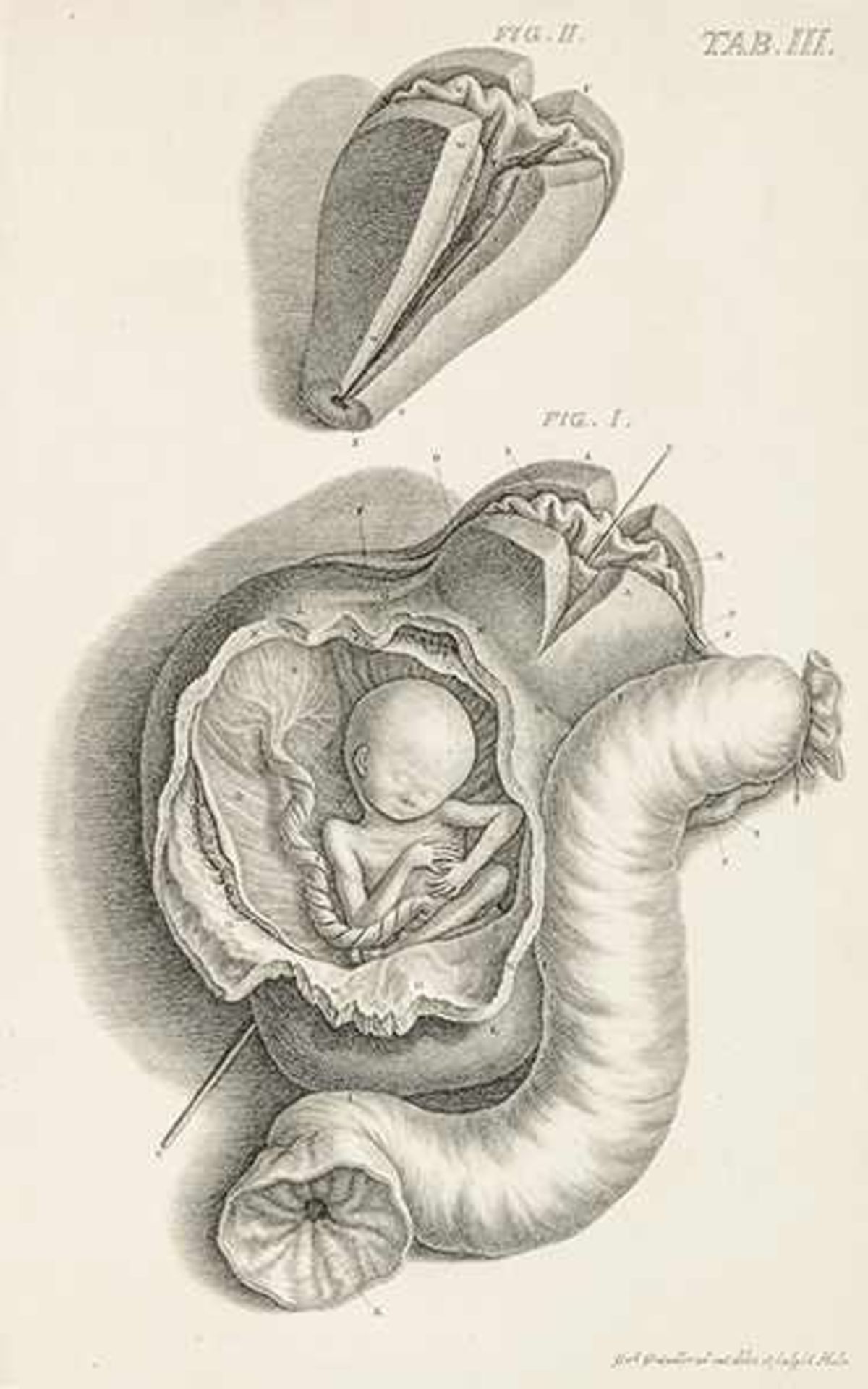 Medizin - Gynäkologie - - Boehmer, Philipp Adolph. Observationum anatomicarum rariorum fasciculus
