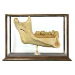 HUMAN JAW,20th century, an anatomical plaster model of a human jaw, mounted in a glass case, 43 x