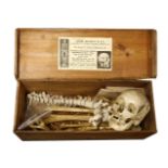 A HUMAN SKELETON,early 20th century, a good medical study half-human skeleton in an original Adam