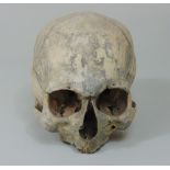 A human skull (lacking lower jaw) and one other