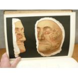 PRINGLE J. J.  A Pictorial Atlas of Skin Diseases … From Models in the Museum of the Saint Louis