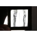 Case of plate slides of medical interest showing joints, tissues, x-rays etc.
