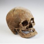 Natural History: A human skull,