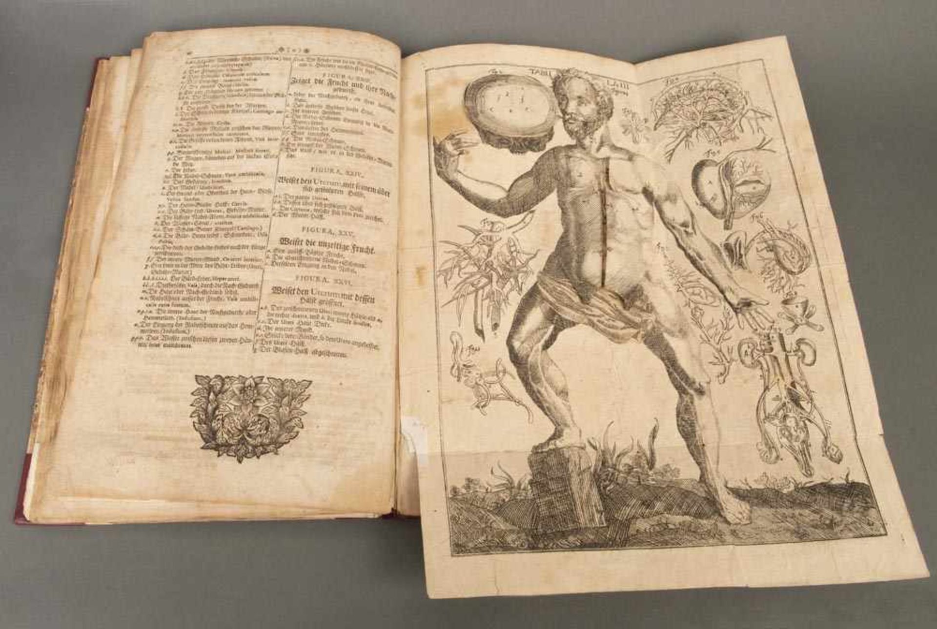 L. Christoph von Hellwig, ?Anatomisches Werck...? mit mehrschichtigen aufklappbaren Kupferstichen - Bild 2 aus 4