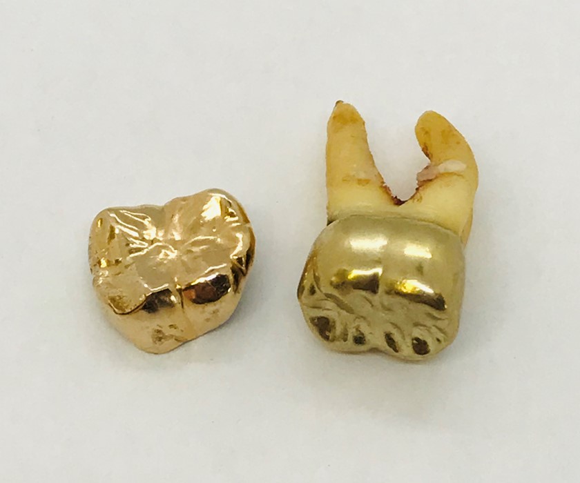Two pieces of dental gold (one attached) Approx 4.5g