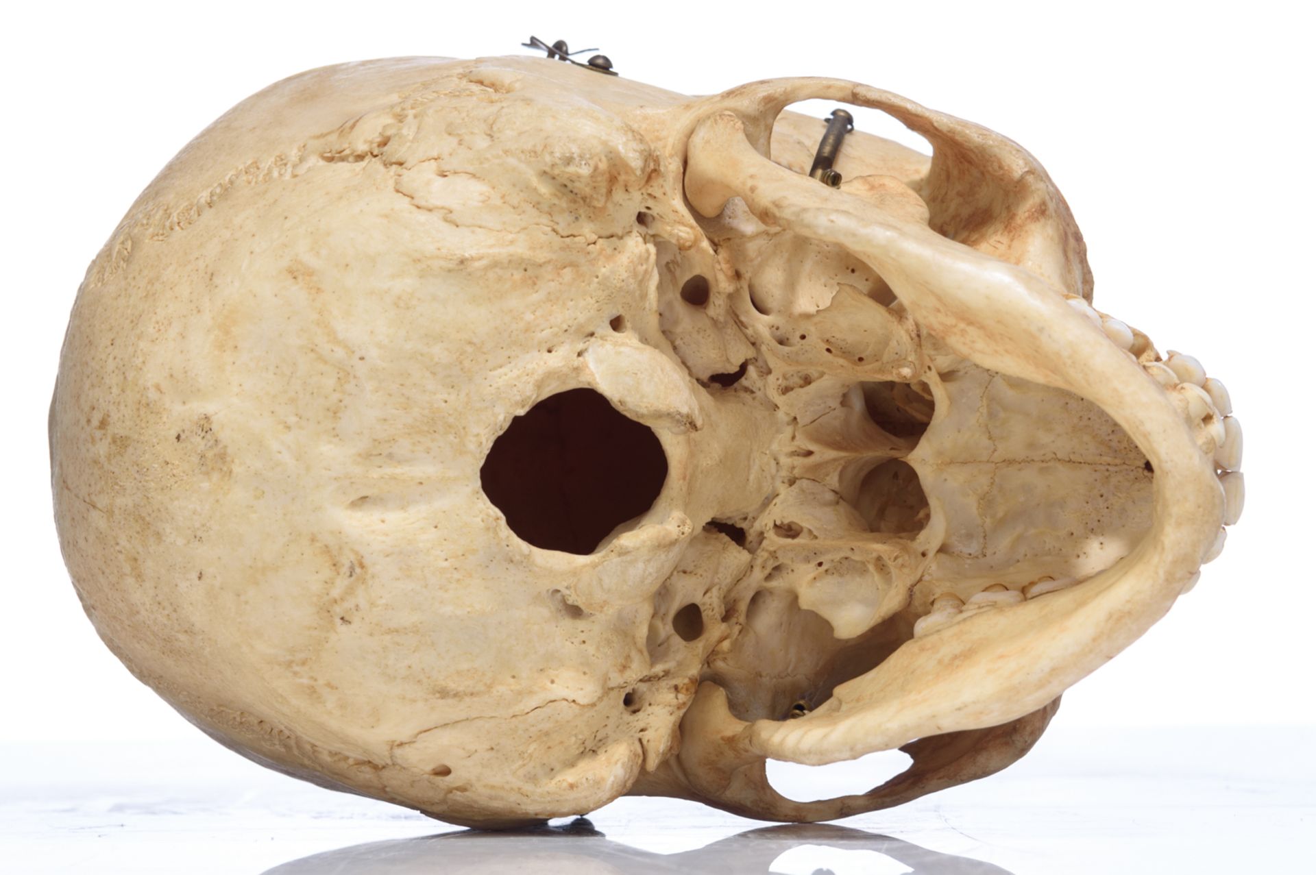 An articulated human skull, the upper cranium with removable section, H 15 cm - Bild 6 aus 10
