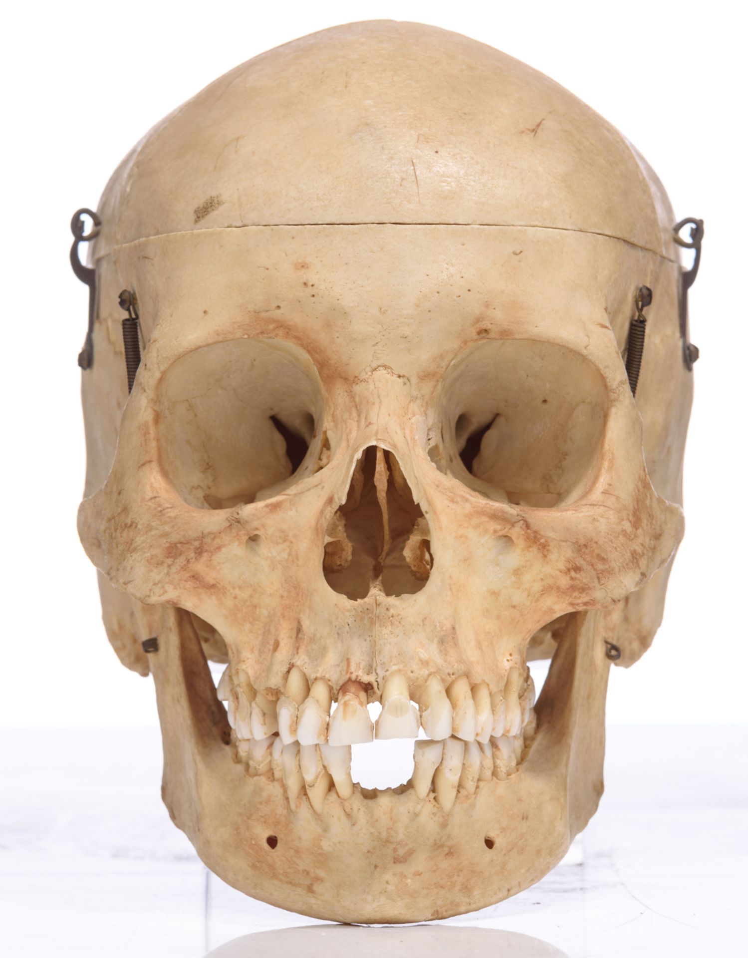 An articulated human skull, the upper cranium with removable section, H 15 cm - Bild 2 aus 10