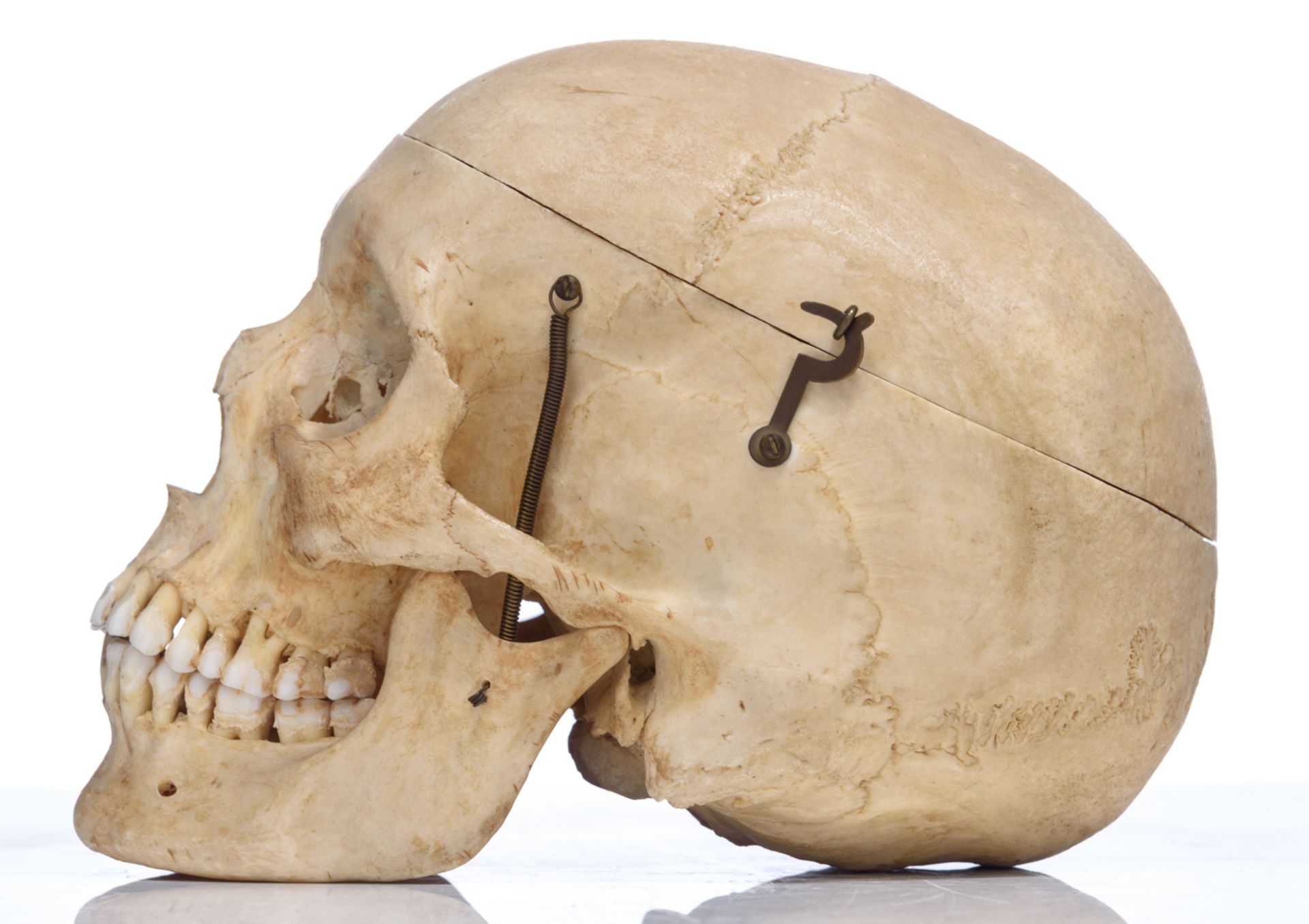 An articulated human skull, the upper cranium with removable section, H 15 cm - Bild 3 aus 10
