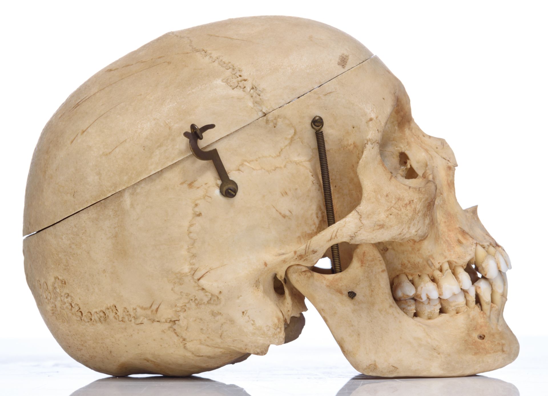 An articulated human skull, the upper cranium with removable section, H 15 cm - Bild 5 aus 10
