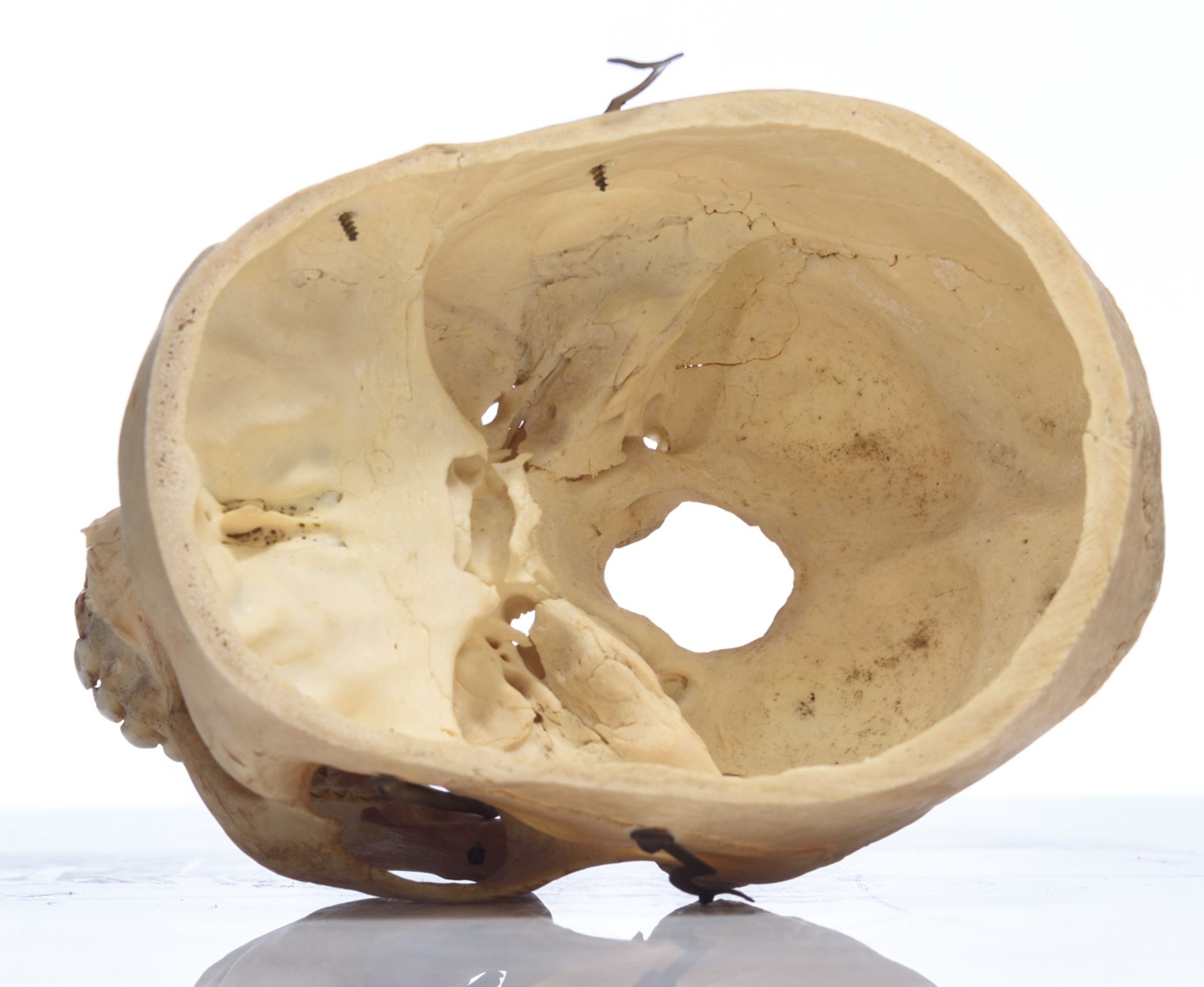 An articulated human skull, the upper cranium with removable section, H 15 cm - Bild 8 aus 10