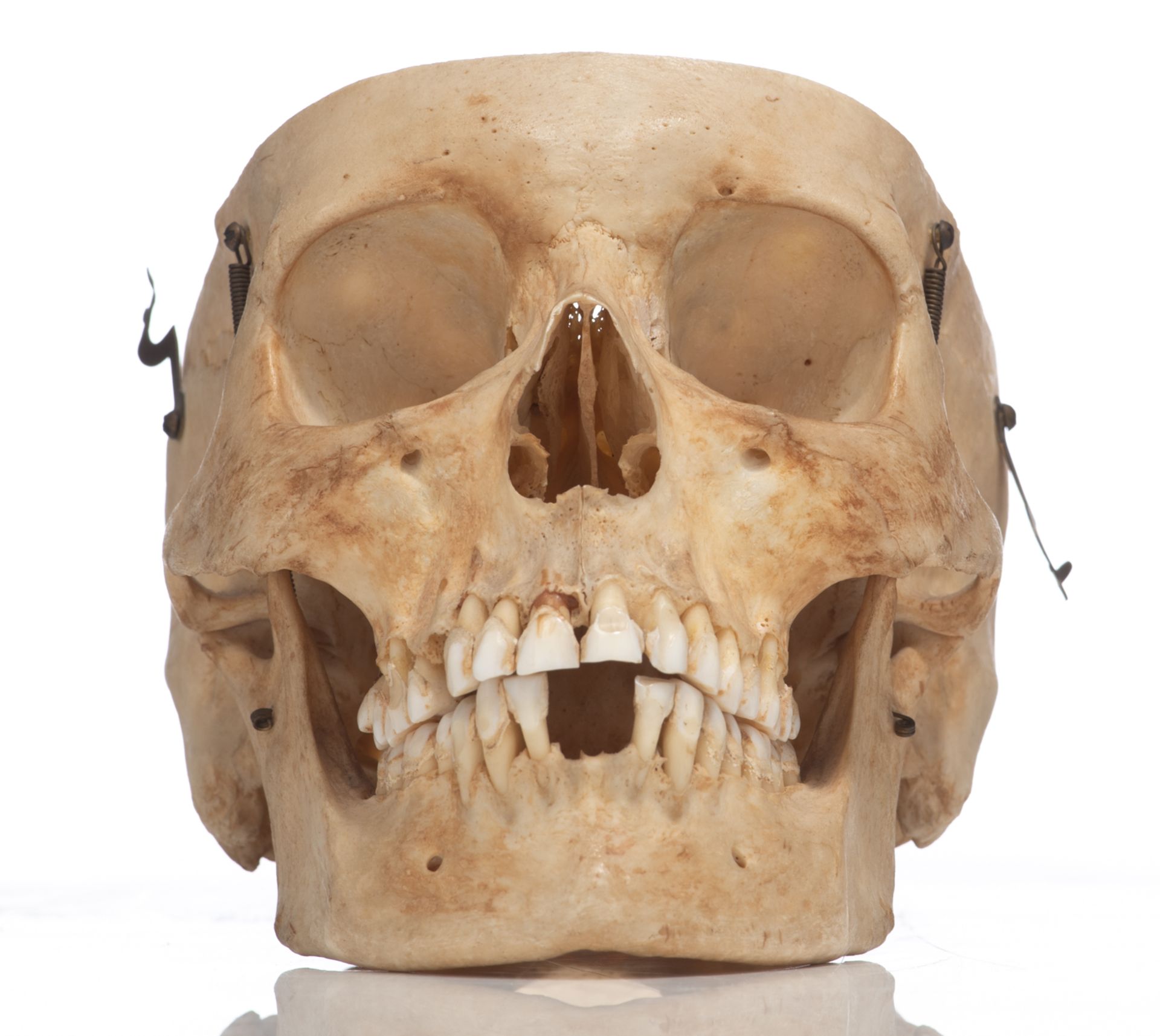 An articulated human skull, the upper cranium with removable section, H 15 cm - Bild 7 aus 10