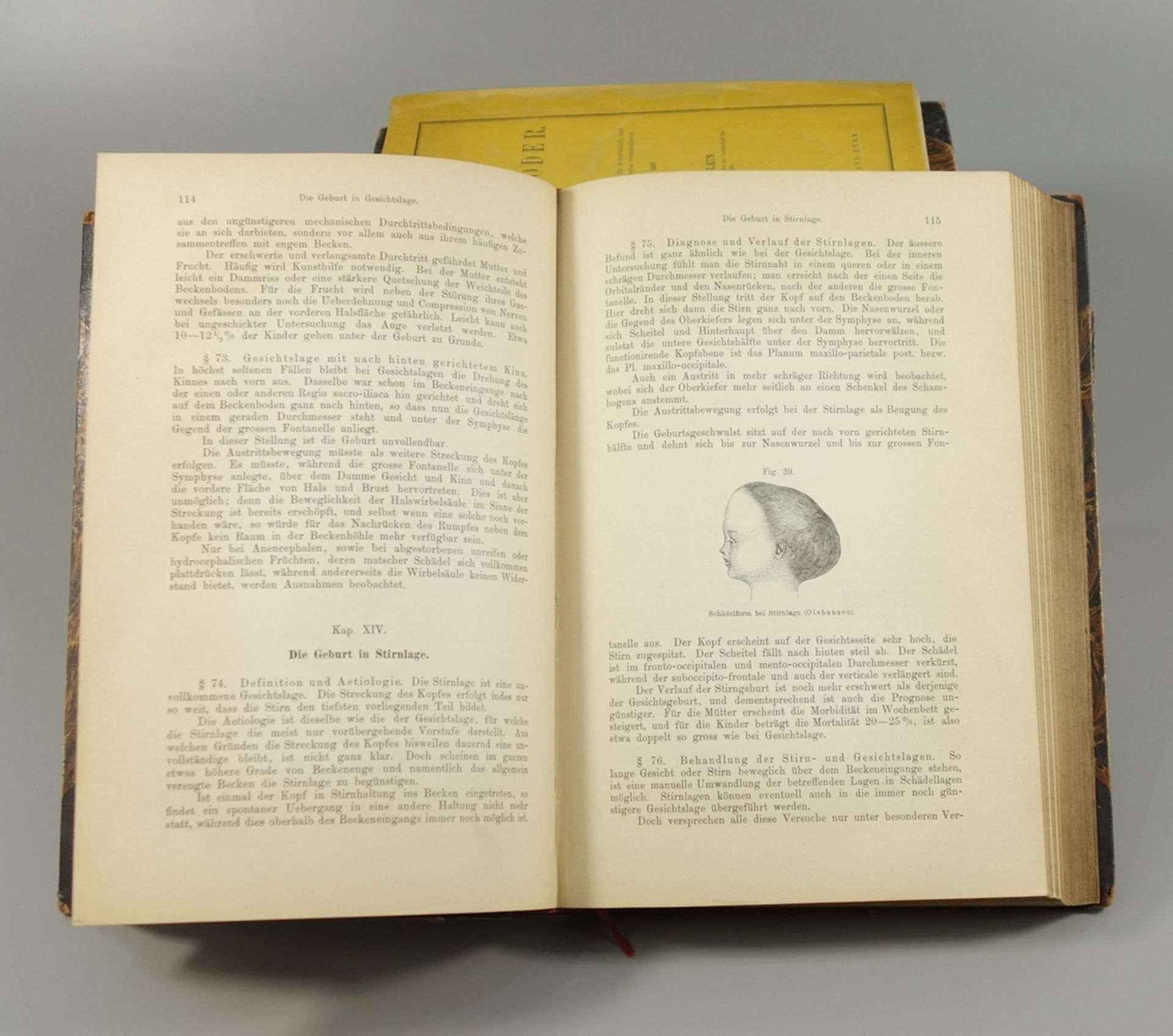 4 Bücher über Geburtshilfe, um 1900: "Grundriss zum Studium der Geburtshülfe in 28 Vorlesungen und - Bild 2 aus 2