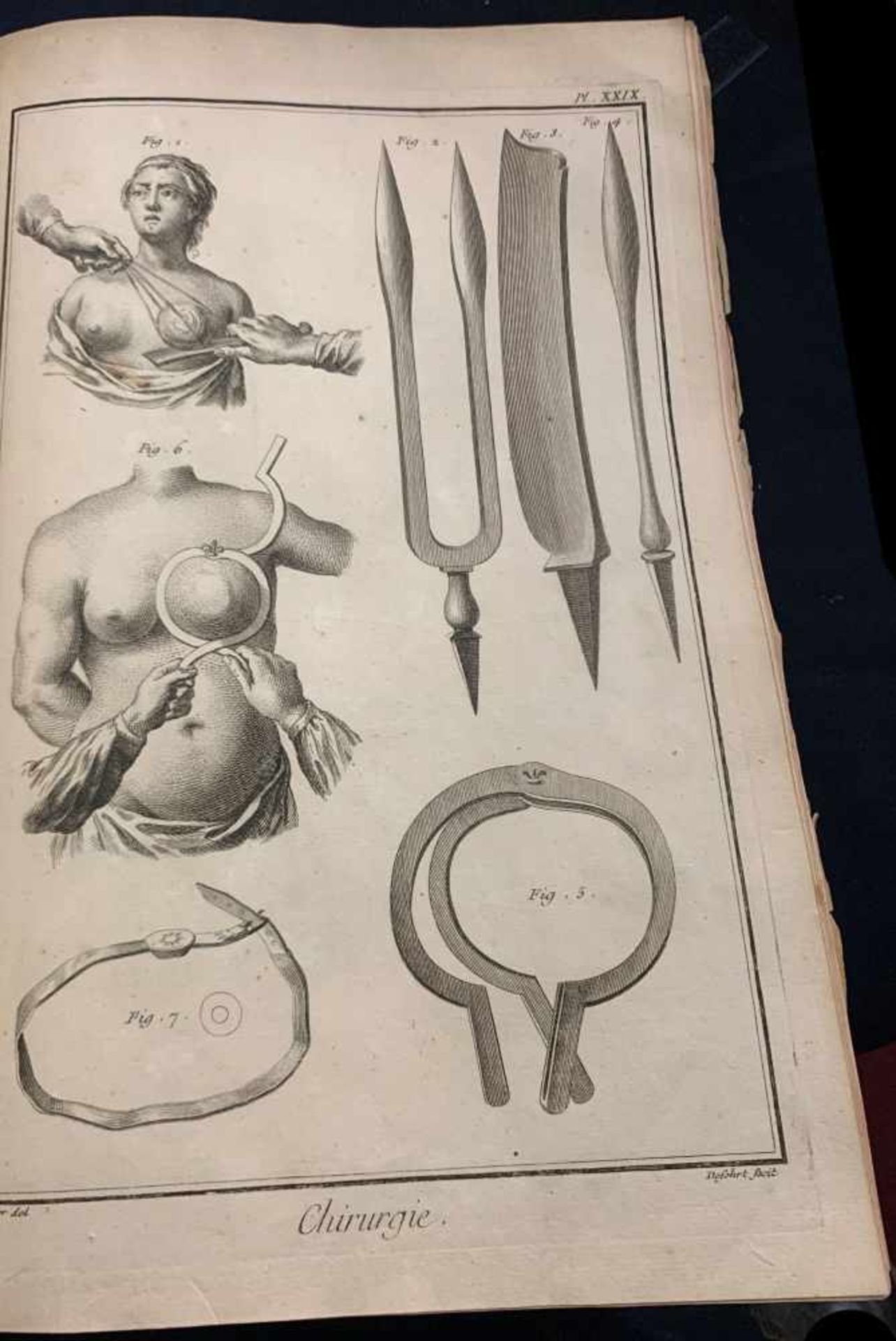 Encyclopédie Chirurgie, französisch. 36 Tafeln. Chirurgische Darstellungen.