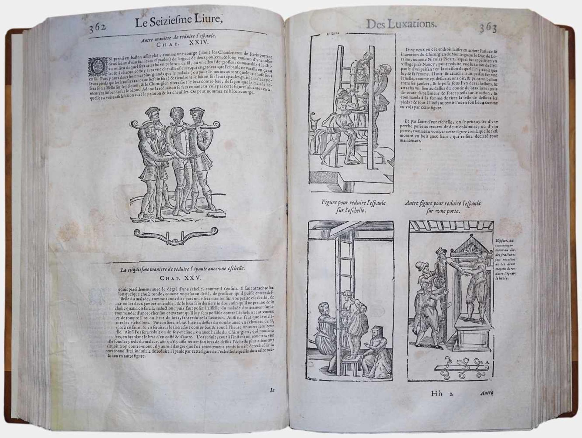 1 Buch "Les oeuvres d´Ambroise Paré, conseillier et premier chirurgien du roy"Lyon 1664 hg. v. - Bild 2 aus 2