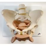 Medical Interest - a 3D anatomical model, female pelvis, display plague