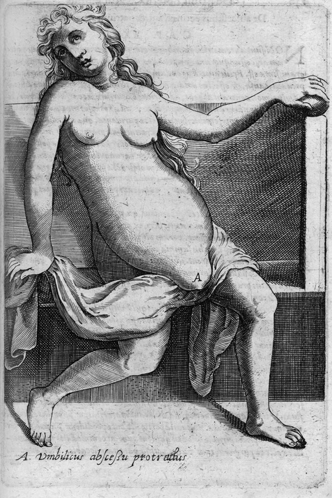 Severino, Marco Aurelio: De recondita abscessuum natura - Bild 3 aus 3
