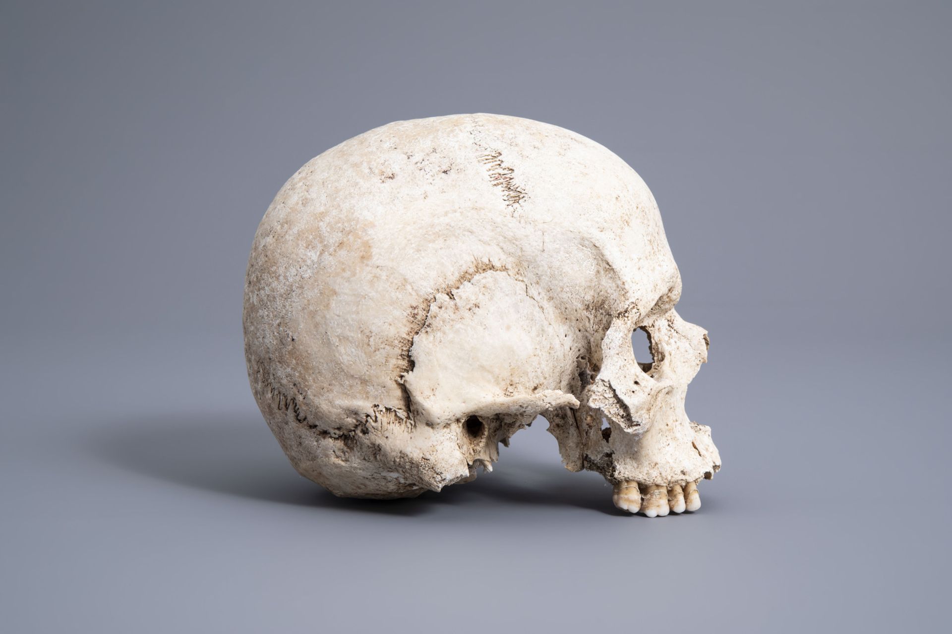 A human skull from an excavated archeological context, 17th/18th C. - Image 2 of 6
