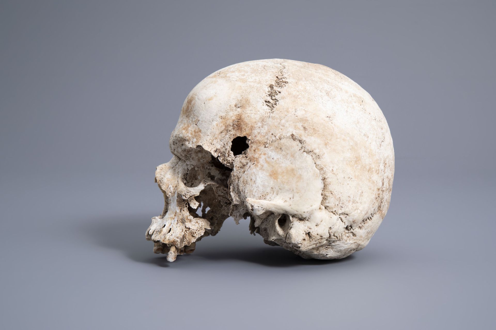 A human skull from an excavated archeological context, 17th/18th C. - Image 4 of 6