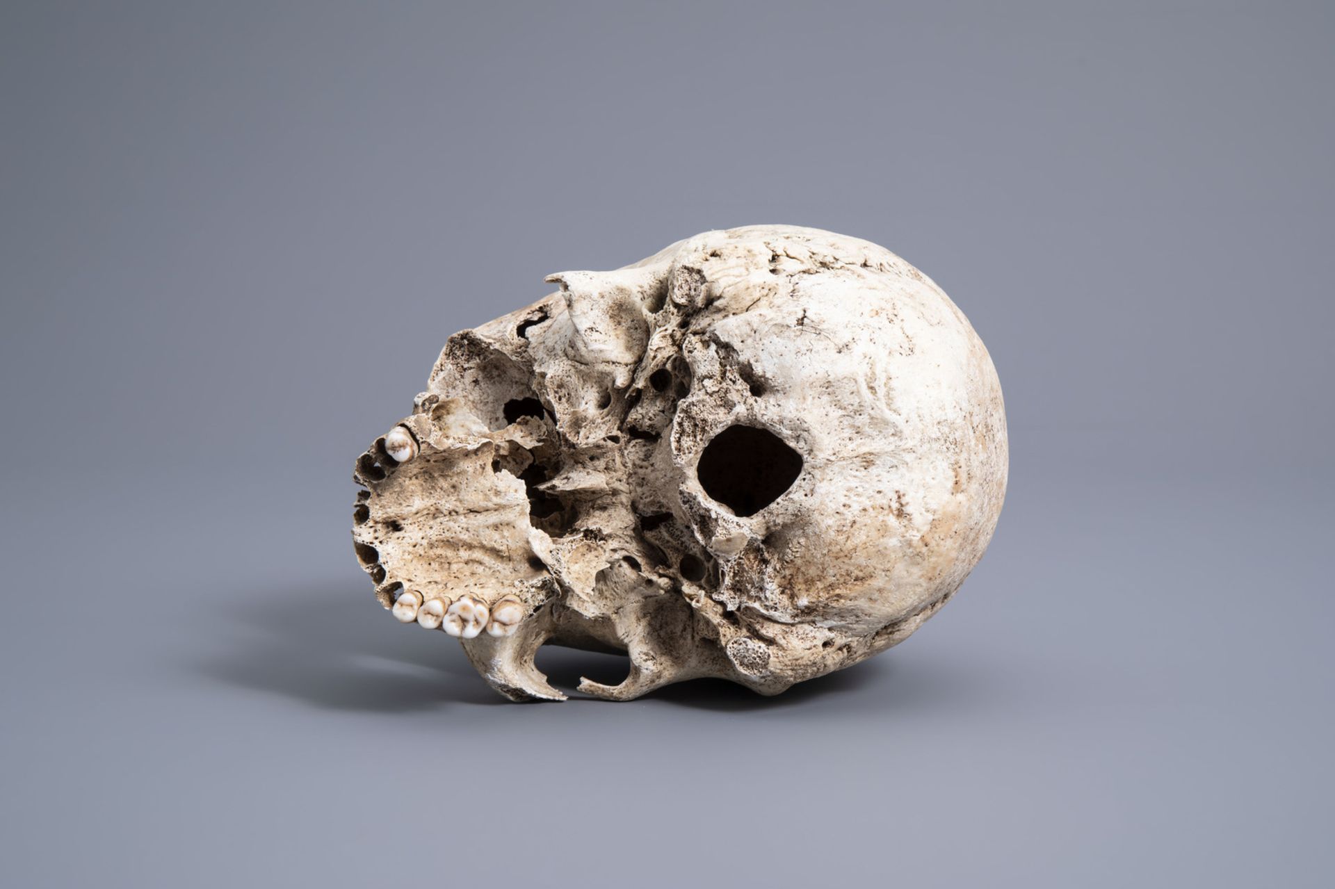 A human skull from an excavated archeological context, 17th/18th C. - Image 5 of 6