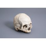 A human skull from an excavated archeological context, 17th/18th C.