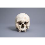 A human skull from an excavated archeological context, 17th/18th C.