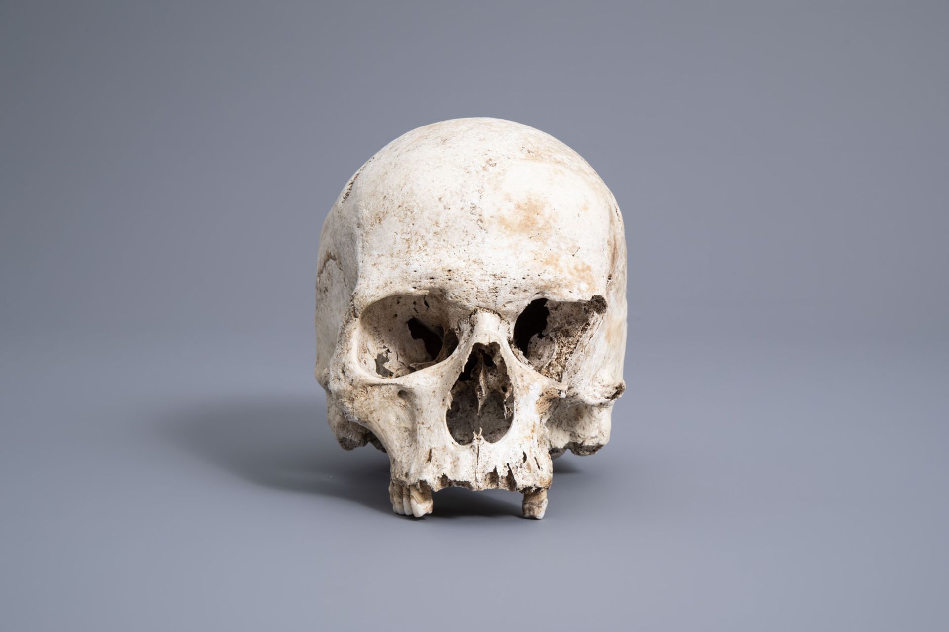 A human skull from an excavated archeological context, 17th/18th C.