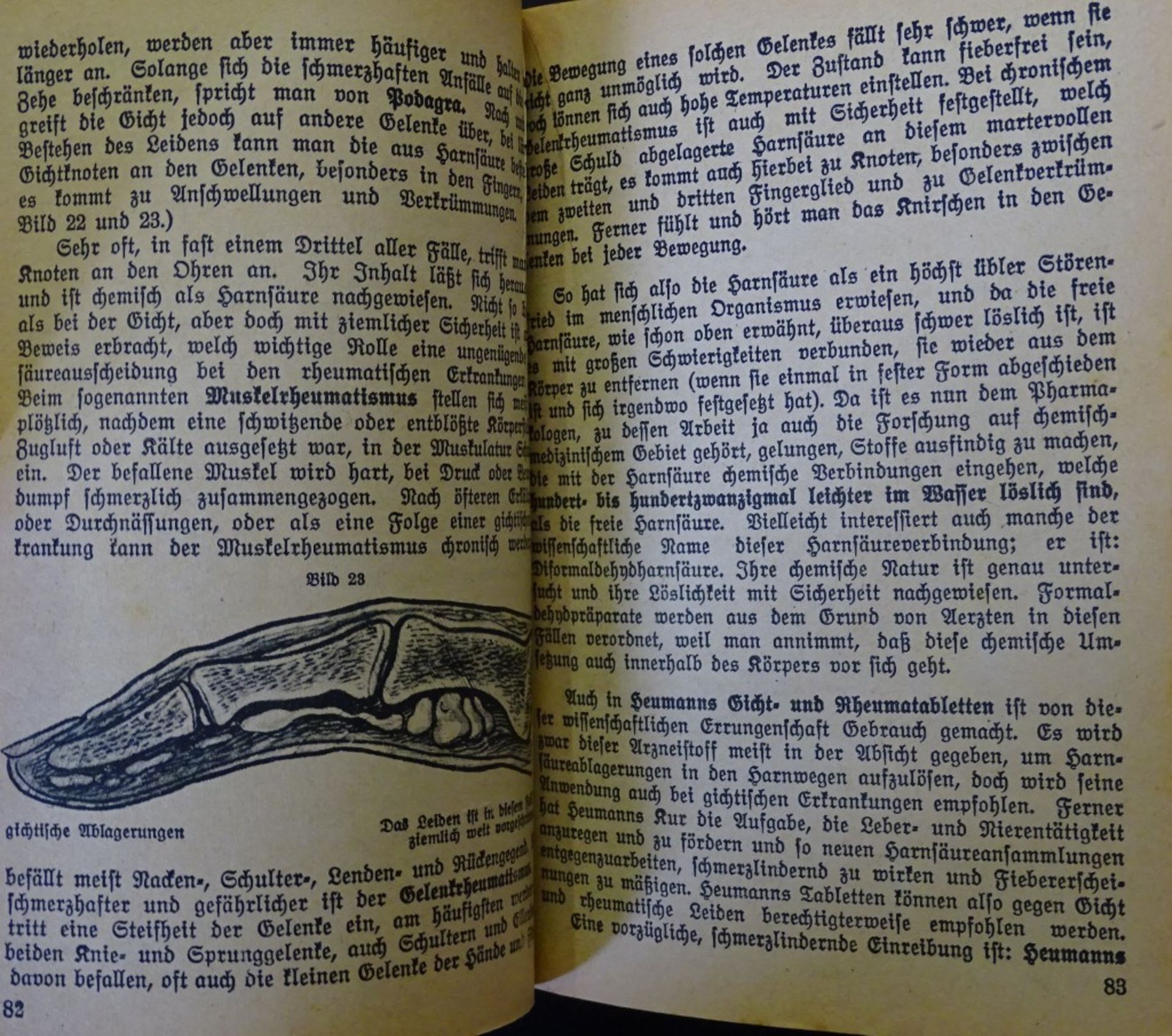 Pfarrer Heumanns "Heilmittel",42.Auflage, 1917 - Bild 5 aus 7