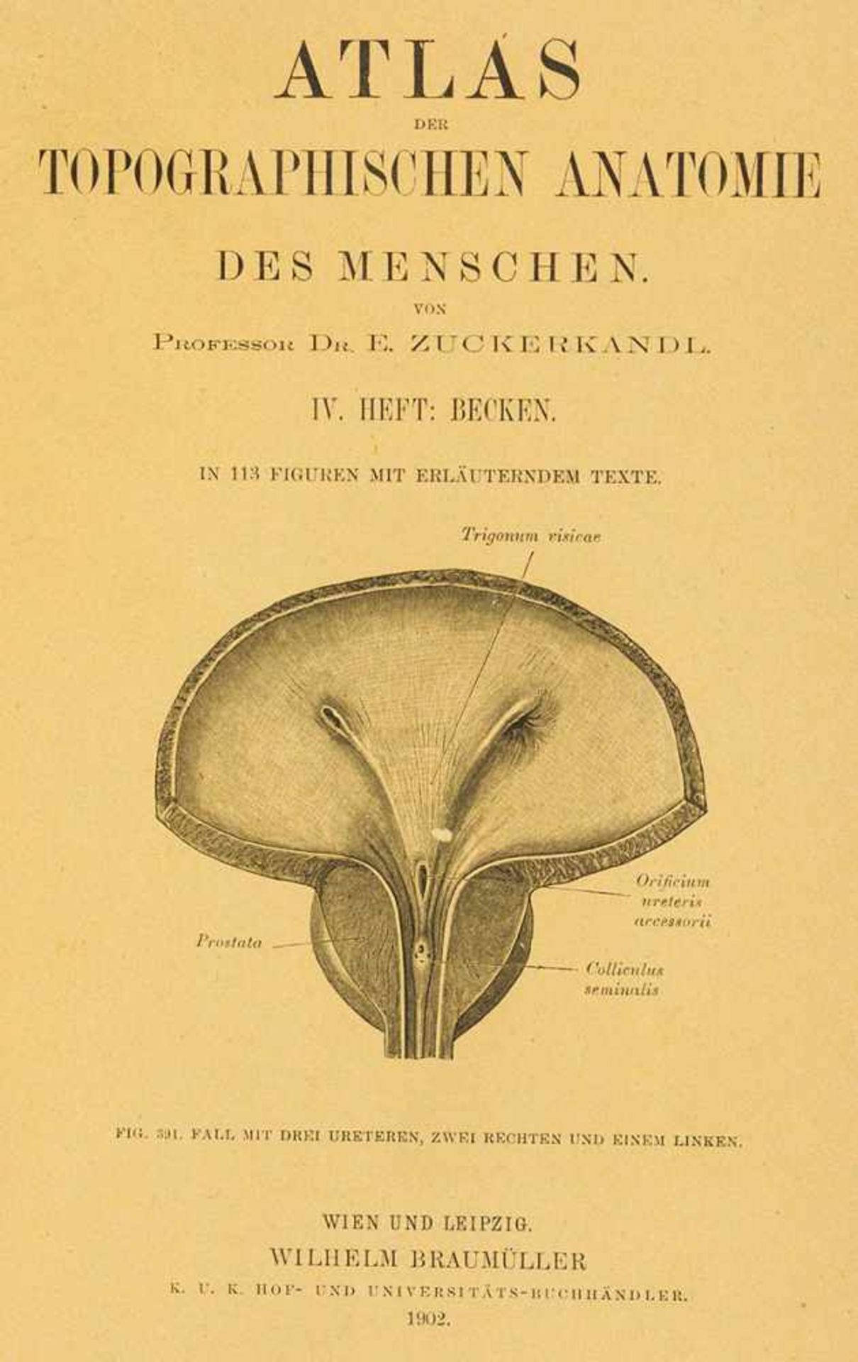 Anatomie. – E. Zuckerkandl. Atlas der topographischen Anatomie des Menschen. 5 Bde. in 2. Wien u.
