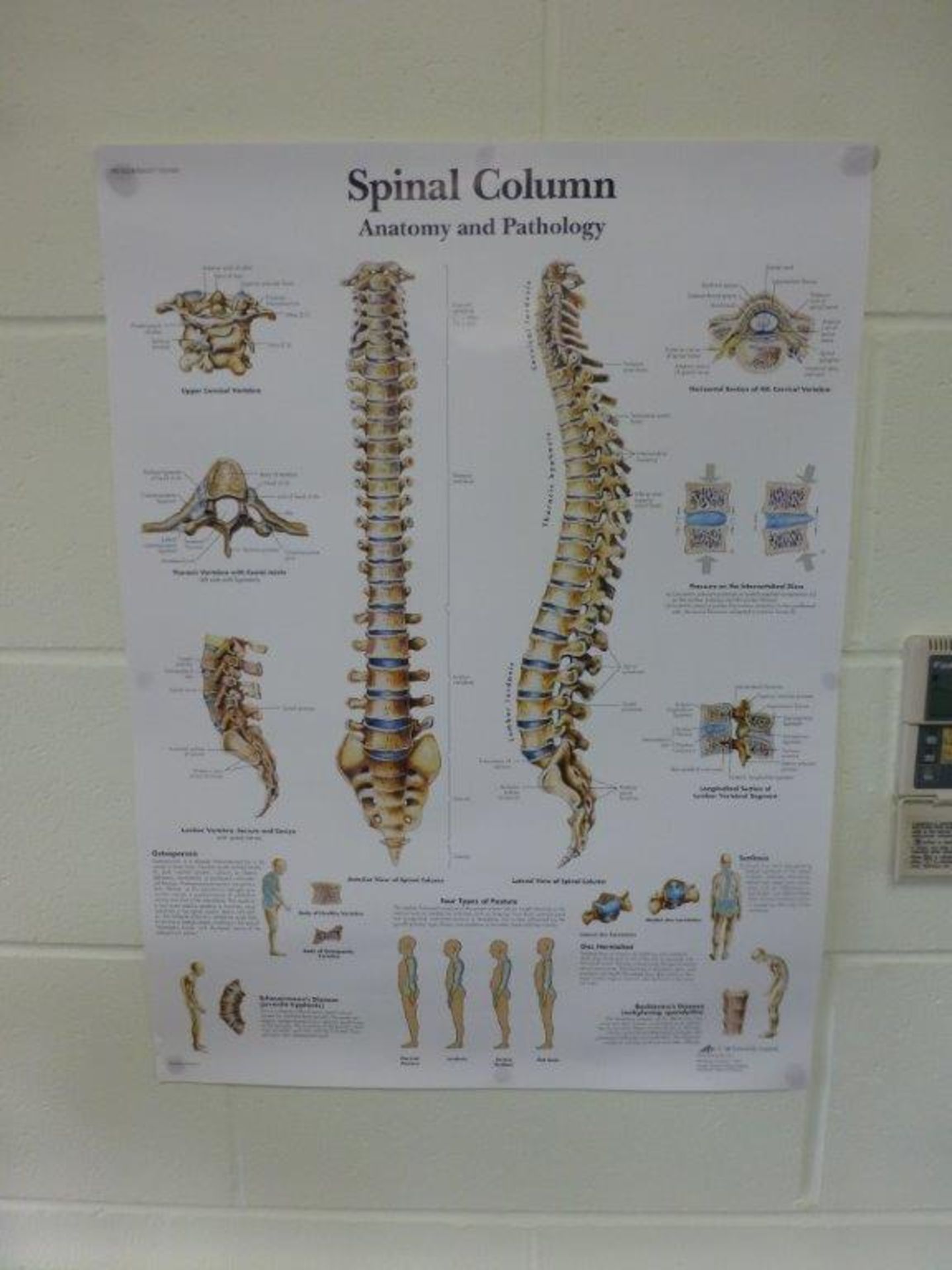 Spinal column teaching aid with information poster - Bild 2 aus 2