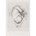 Anatomy.- Hunter (William) Anatomia Uteri Humani Gravidi ... The Anatomy of the Human Gravid …