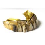 A gold and ivory (probably Walrus or Hippo) upper set of dentures dating c. 1800-1850.