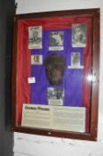 The Herman Goring Death Mask with Ephemera in Showcase