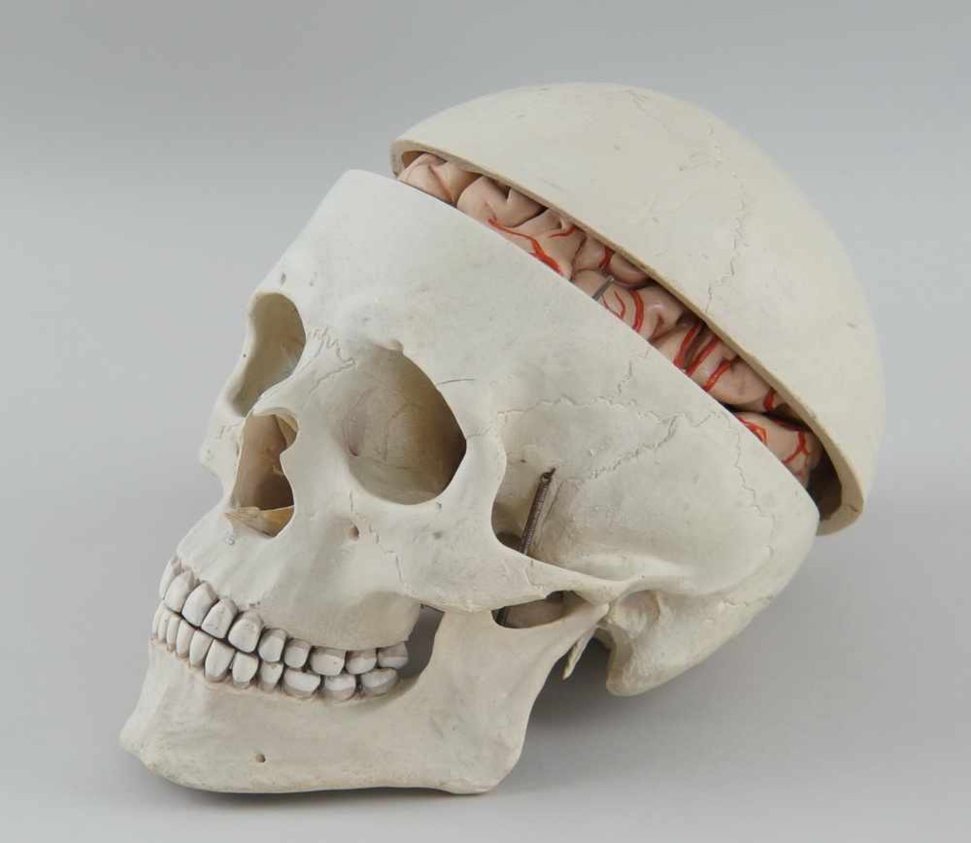 Anatomisches Modell eines menschlichen Schädels mit Gehirn, Schädeldecke etwas verzogen,<b