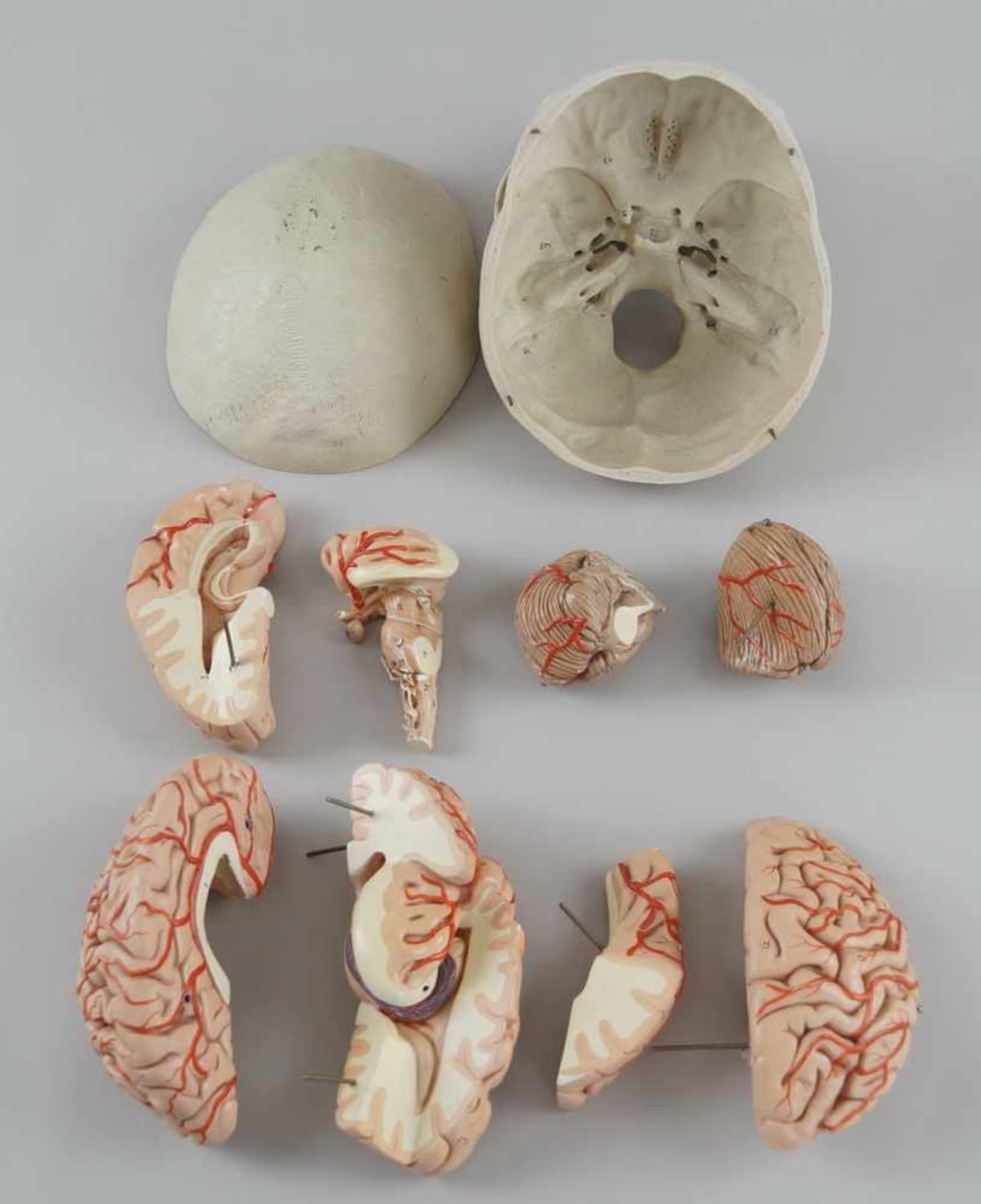 Anatomisches Modell eines menschlichen Schädels mit Gehirn, Schädeldecke etwas verzogen,<b - Bild 6 aus 6