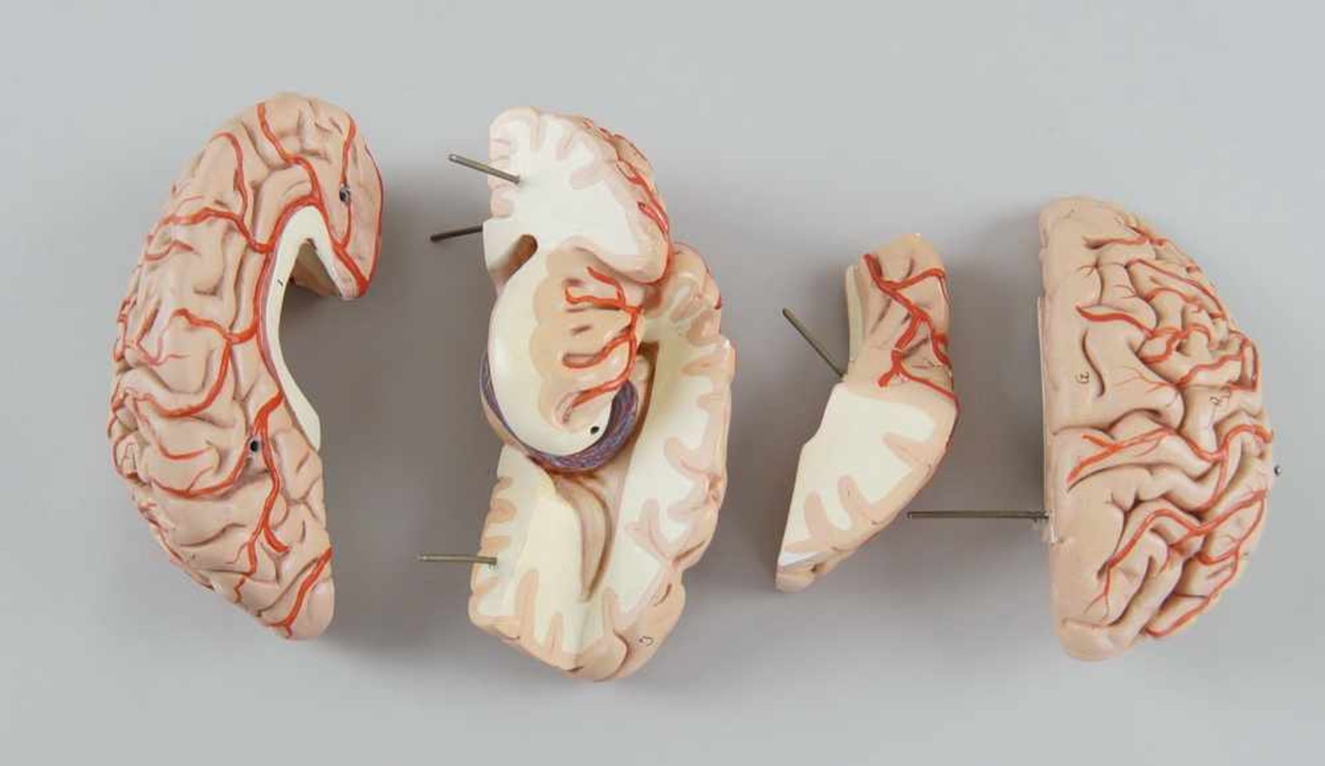 Anatomisches Modell eines menschlichen Schädels mit Gehirn, Schädeldecke etwas verzogen,<b - Bild 5 aus 6