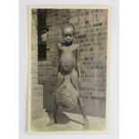 Medical. Elephantiasis - nude native child with swollen testicles, real photo postcard published