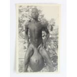 Medical. Elephantiasis - nude native man with swollen testicles, real photo postcard published by