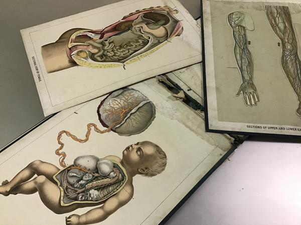 A 1ate 19th century "Physician's Anatomical Aid, a Manikin (sic) of Superimposed Diagramatic