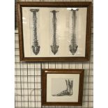TWO ANATOMICAL ETCHINGS C1850