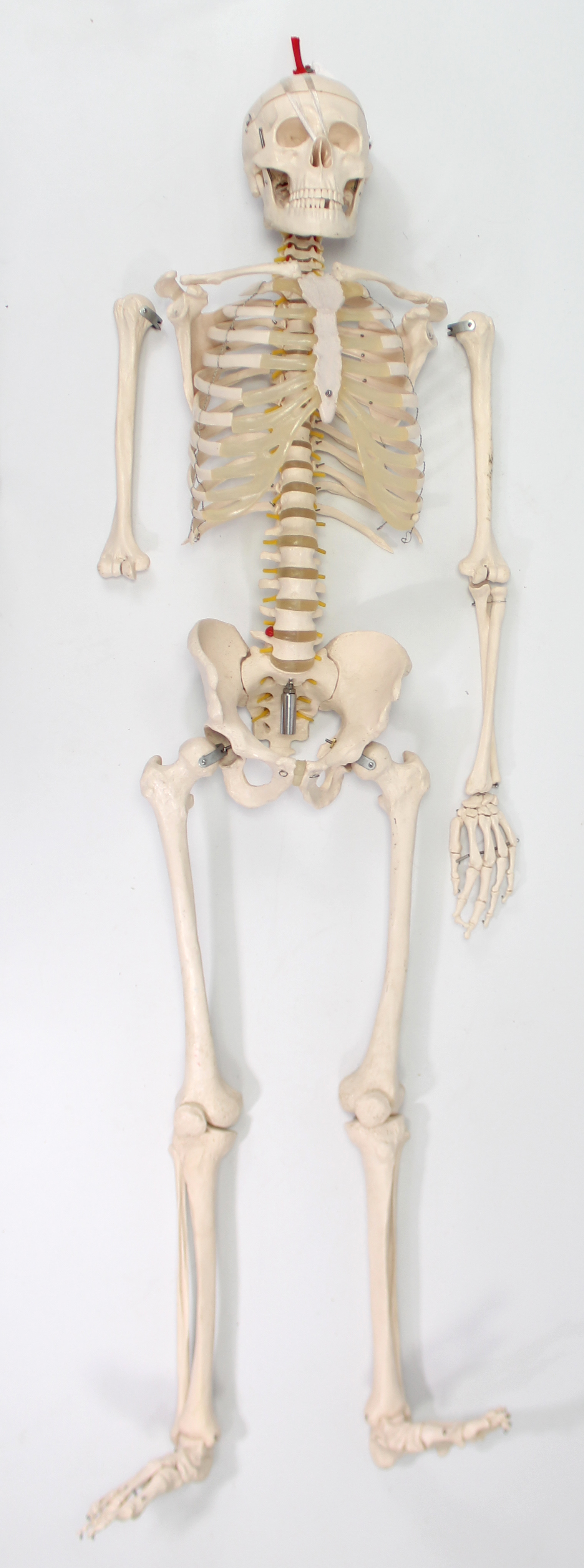 A resin medical skeleton specimen (lacking lower right arm), 5’5” high; & a composition