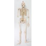 A resin medical skeleton specimen (lacking lower right arm), 5’5” high; & a composition