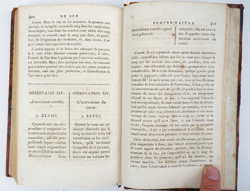 AUENBRUGGER, Leopold (1722-1809) & Jean-Nicolas CORVISART (1755-1821, translator & editor). - Image 4 of 4