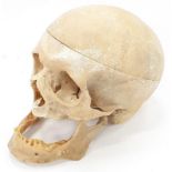 Of medical interest and anatomical Victorian skull.