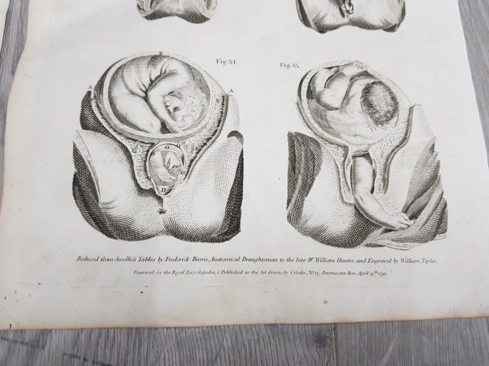 TWO 18TH CENTURY PLATE ENGRAVINGS DEPICTING THE MALE AND FEMALE PELVIS ENGRAVED BY J TAYLOR - Image 3 of 3