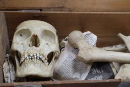 A vintage medical skeleton, pine boxed