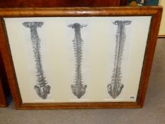 FOUR ANTIQUE HAND COLOURED ANATOMICAL PRINTS, THREE OF VERTEBRAE MOUNTED AS ONE AND ANOTHER OF A