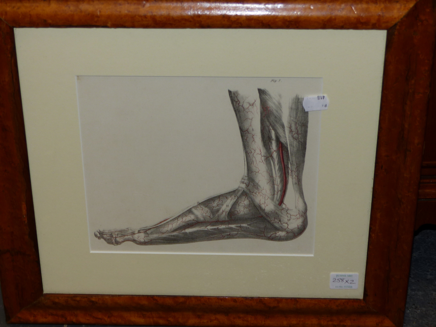 FOUR ANTIQUE HAND COLOURED ANATOMICAL PRINTS, THREE OF VERTEBRAE MOUNTED AS ONE AND ANOTHER OF A - Image 3 of 3