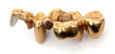 A gold dental crown, 10.2gms