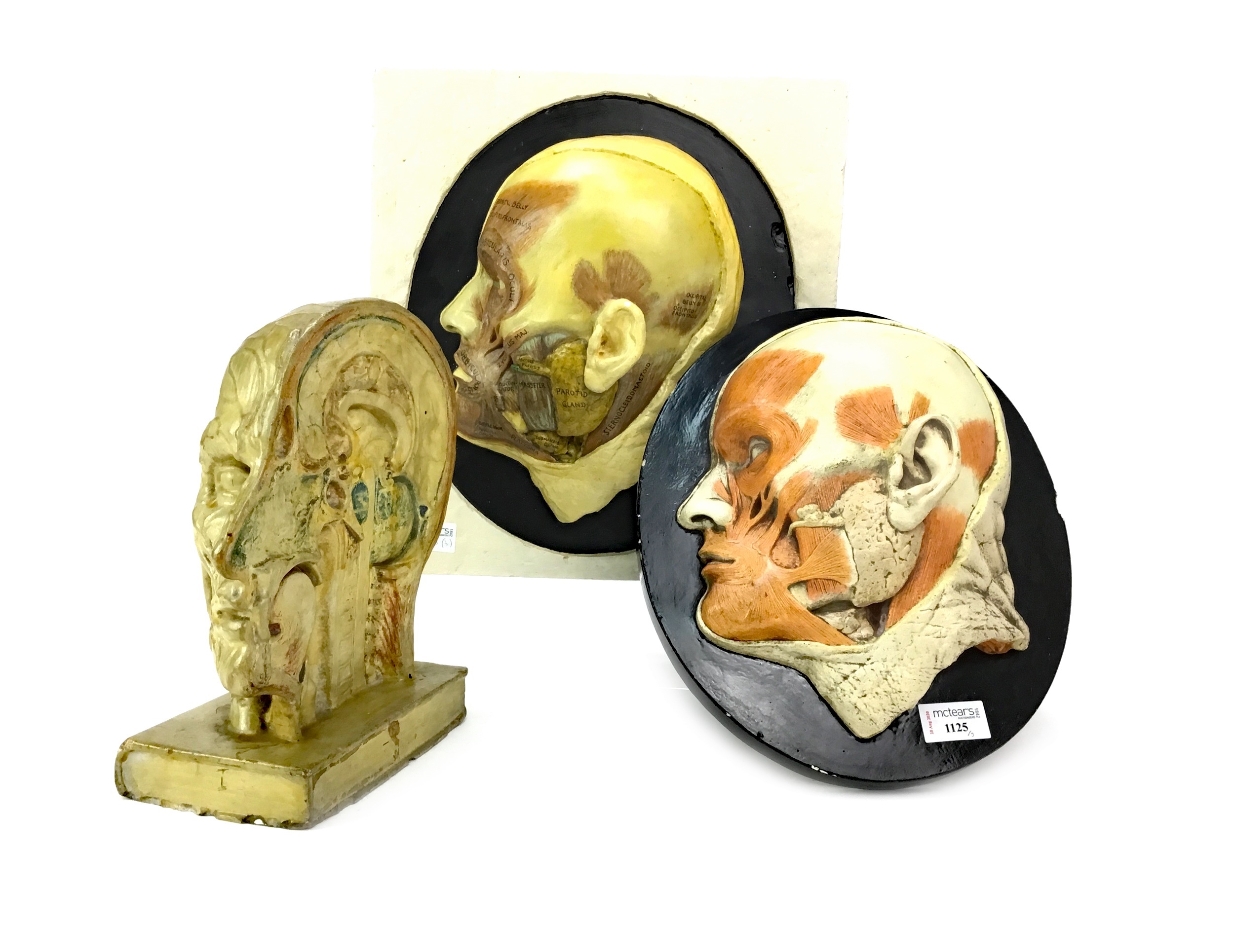 AMENDMENT: THREE FRENCH PLASTER ANATOMICAL MODELS OF CUT AWAY HUMAN SKULLS