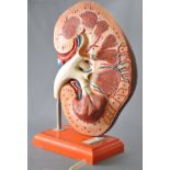 A late 20th Century retro vintage anatomical medical scale model depicting an oversized kidney